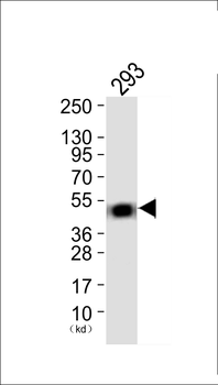 Prostate Apoptosis Response protein-4 Antibody