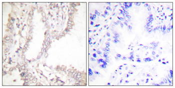 Prostate Apoptosis Response protein-4 Antibody