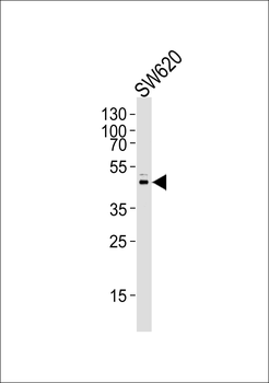 Prostate Apoptosis Response protein-4 Antibody