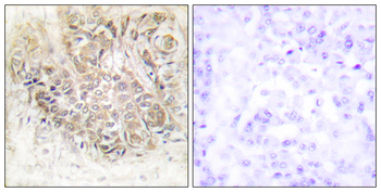 TCTP Antibody