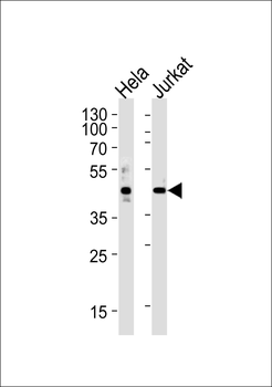 AVPR2 Antibody