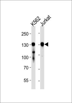 PHKB Antibody