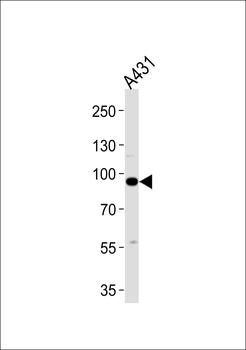 C1S Antibody