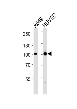 ADCY9 Antibody