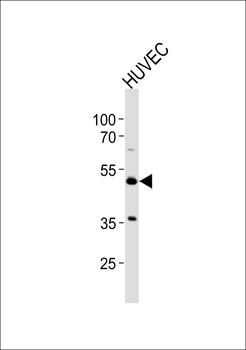 Prostacyclin Receptor Antibody