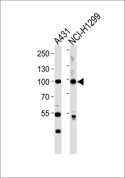 FA13A (Cleaved-Gly39) Antibody