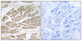 BRP44L Antibody