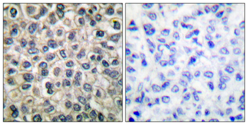 Catenin-γ Antibody