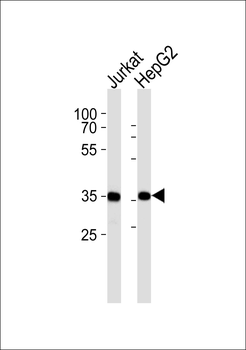 PDLIM1 Antibody
