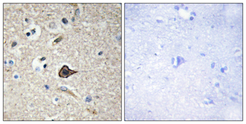 TNF12 Antibody