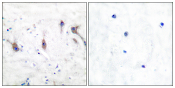 ARC Antibody