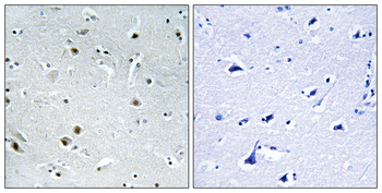 DDX24 Antibody