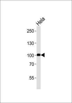DDX24 Antibody