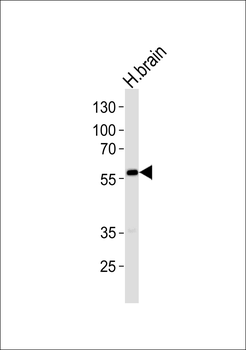 ALDH1A2 Antibody