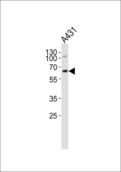 MNT Antibody