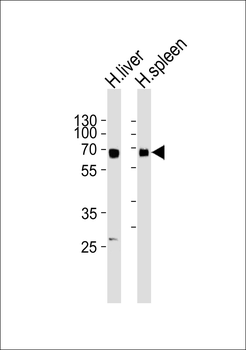 GBA3 Antibody