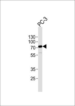 RABEP2 Antibody