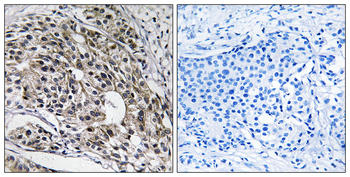 MRPL13 Antibody