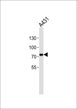 C1S Antibody (heavy chain, Cleaved-Arg437)