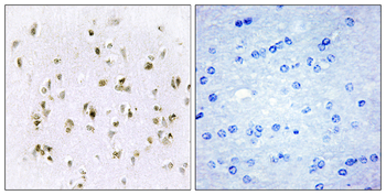 HMG17 Antibody