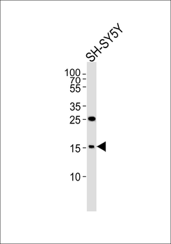 HMG17 Antibody