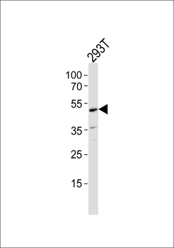 CDK5RAP3 Antibody