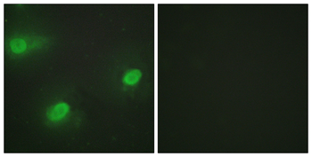 CSTF2 Antibody
