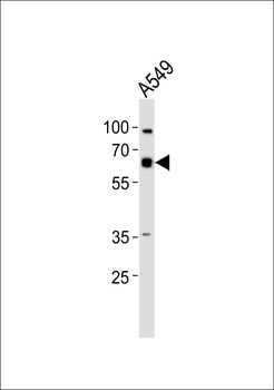 CSTF2 Antibody