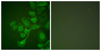TIMP2 Antibody