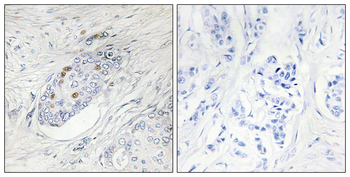 ZNF232 Antibody