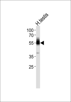 ZNF232 Antibody