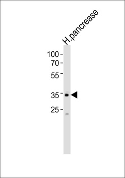 ALX3 Antibody