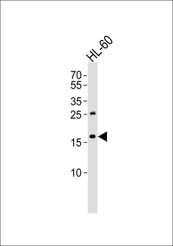 TRAPPC3 Antibody