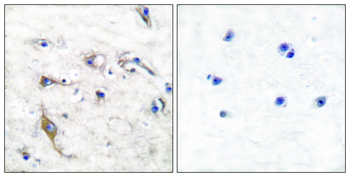 JM4 Antibody