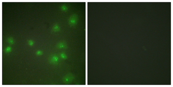 ZNF265 Antibody