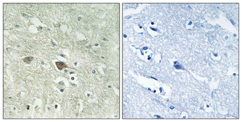NDUFV3 Antibody