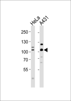 PSMD2 Antibody
