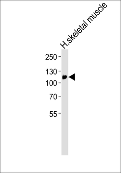 ACAD10 Antibody