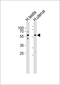 B3GALTL Antibody