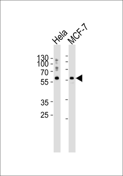 TOR1AIP1 Antibody