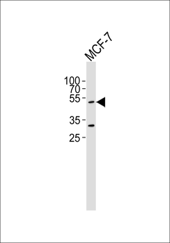 TEAD2 Antibody