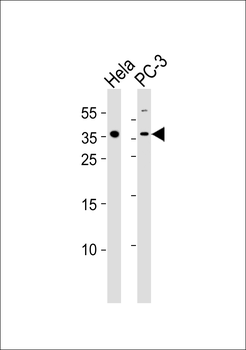 GUSBL1 Antibody