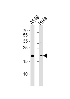 ATP5L2 Antibody