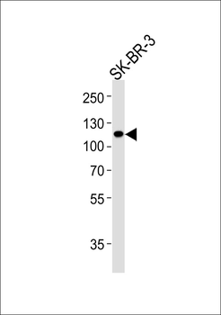 IARS2 Antibody