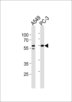 RSAD1 Antibody