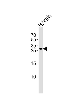 RIMS4 Antibody
