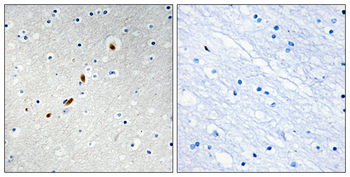 ZNF596 Antibody