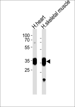 DOK4 Antibody