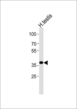 AGPAT3 Antibody
