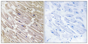 MRPL16 Antibody